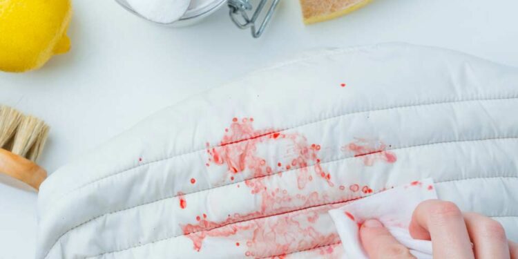 Blutflecken entfernen (depositphotos.com)